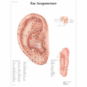 Acupunctuur