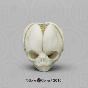 Foetus Schedel Set, 4-delig, met Lesplan