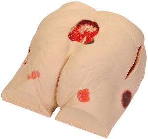 Decubitus (Ulcus) model