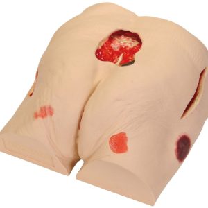 Decubitus (Ulcus) model