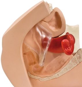 Anticonceptie Trainer Vrouw