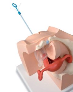 Anticonceptie Trainer Vrouw
