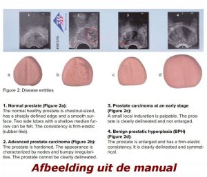 Prostaatonderzoek trainer
