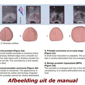 Prostaatonderzoek trainer