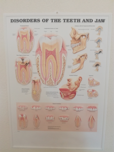 3D Reliëf Poster Aandoeningen aan Gebit en Kaak