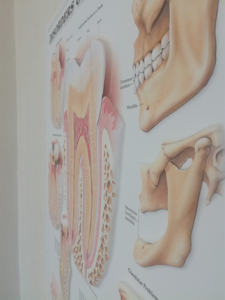 3D Reliëf Poster Aandoeningen aan Gebit en Kaak