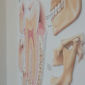 3D Reliëf Poster Aandoeningen aan Gebit en Kaak
