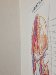 3D Reliëf Poster Anatomie en Blessures van de Heup