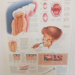 3D Reliëf Poster Het Gebit