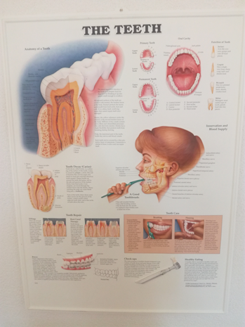 3D Reliëf Poster Het Gebit
