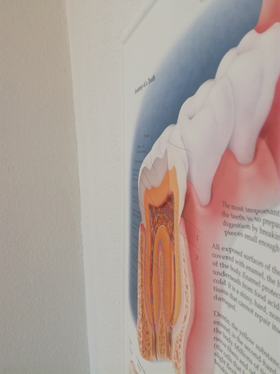 3D Reliëf Poster Het Gebit