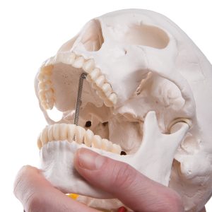 Schedel op cervicale wervelkolom