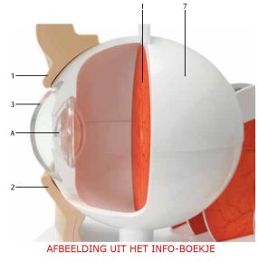Oog met ziektebeelden