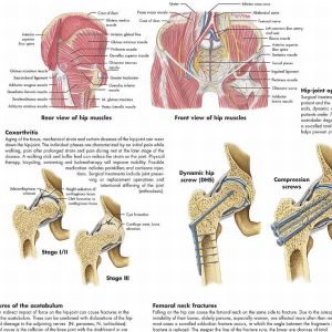 Anatomie Poster Heup en Bekken, gelamineerd