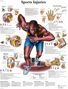 Anatomie Poster Sportblessures, gelamineerd