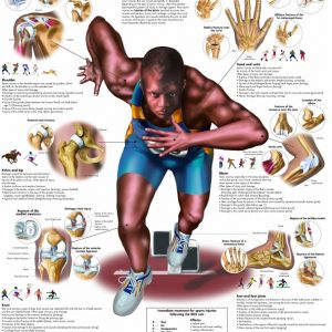Anatomie Poster Sportblessures, gelamineerd