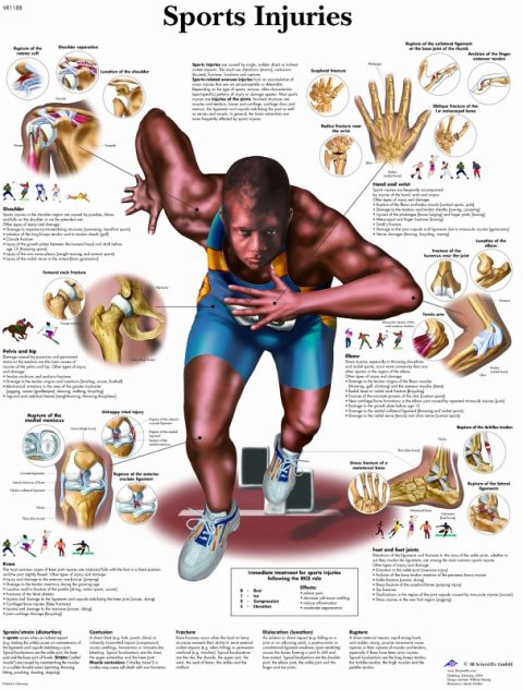 Anatomie Poster Sportblessures, gelamineerd