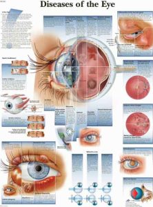 Anatomie Poster Ziektebeelden van het Oog, gelamineerd