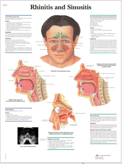 Rhinitis & Sinusitis, papieren wandplaat