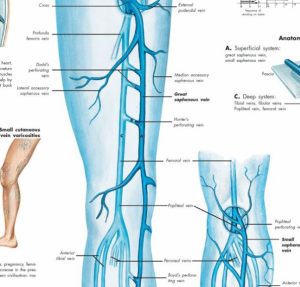 Anatomie Poster Varicose Veins (spat-aderen), papier