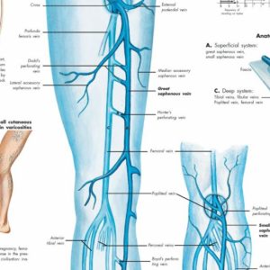 Anatomie Poster Varicose Veins (spat-aderen), papier