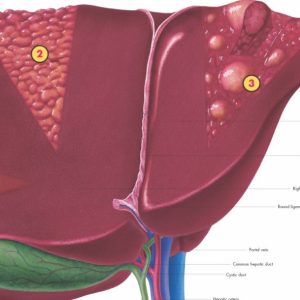 Hepatitis, papieren wandplaat