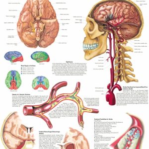 Anatomie Poster Hersenbloeding, papier