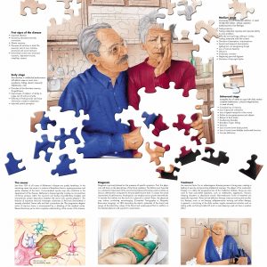 Alzheimer, papieren wandplaat