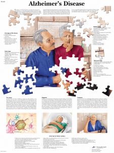 Alzheimer, gelamineerde wandplaat
