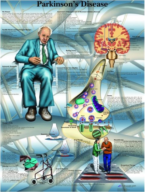Parkinson, papieren wandplaat