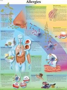 Allergie, gelamineerde wandplaat