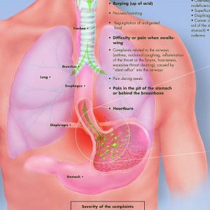 Reflux papieren wandplaat