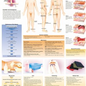 Anatomie Poster Decubitus, papier