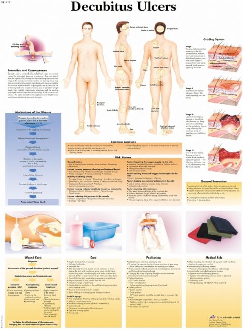 Anatomie Poster Decubitus, gelamineerd