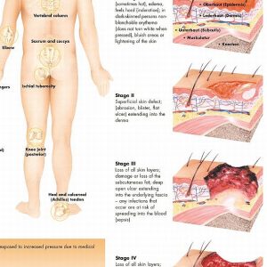 Anatomie Poster Decubitus, papier