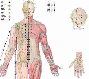 Body Acupuncture, gelamineerde wandplaat