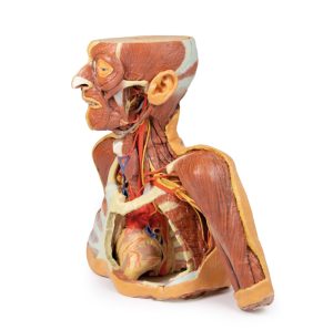 Hoofd-Nek-Schouder Angiosoom, 3Dprint