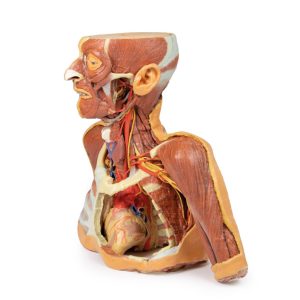 Hoofd-Nek-Schouder Angiosoom, 3Dprint