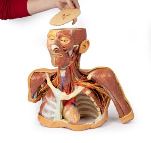 Hoofd-Nek-Schouder Angiosoom, 3Dprint
