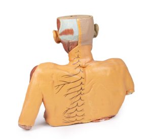 Hoofd-Nek-Schouder Angiosoom, 3Dprint