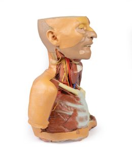 Hoofd-Nek-Schouder Angiosoom, 3Dprint