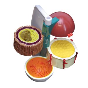 4-delig Diabetes Model