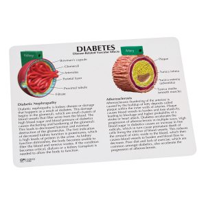4-delig Diabetes Model