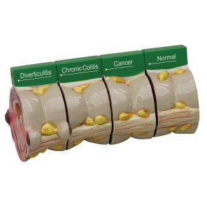 4-delig dikke darm model