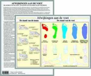 Afwijkingen aan de Voet A4 Kaart Nederlands