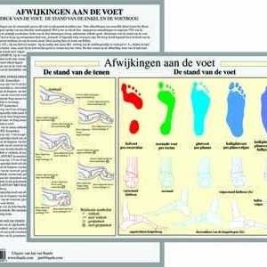 Afwijkingen aan de Voet A4 Kaart Nederlands