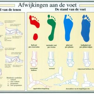 Afwijkingen aan de Voet Poster A2 Nederlands