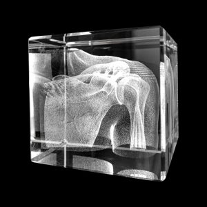 Anatomie Glasblok Schouder
