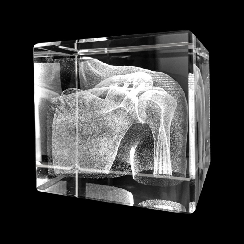 Anatomie Glasblok Schouder