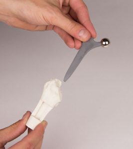 Heupimplantaat Model